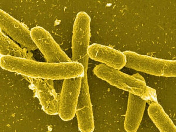  Какво показва проверката на БАБХ заради случаите на салмонелоза сред деца във Варна?